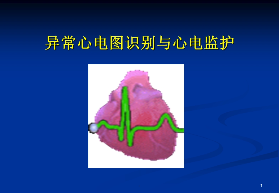 心电图与心电监护课件.ppt_第1页