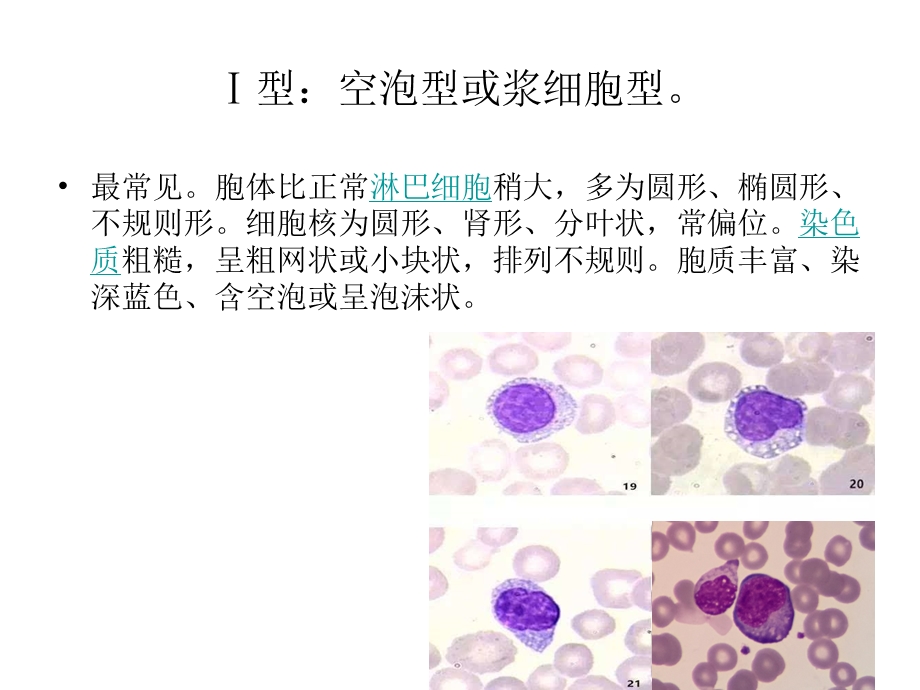 异常淋巴细胞形态PPT课件.ppt_第3页