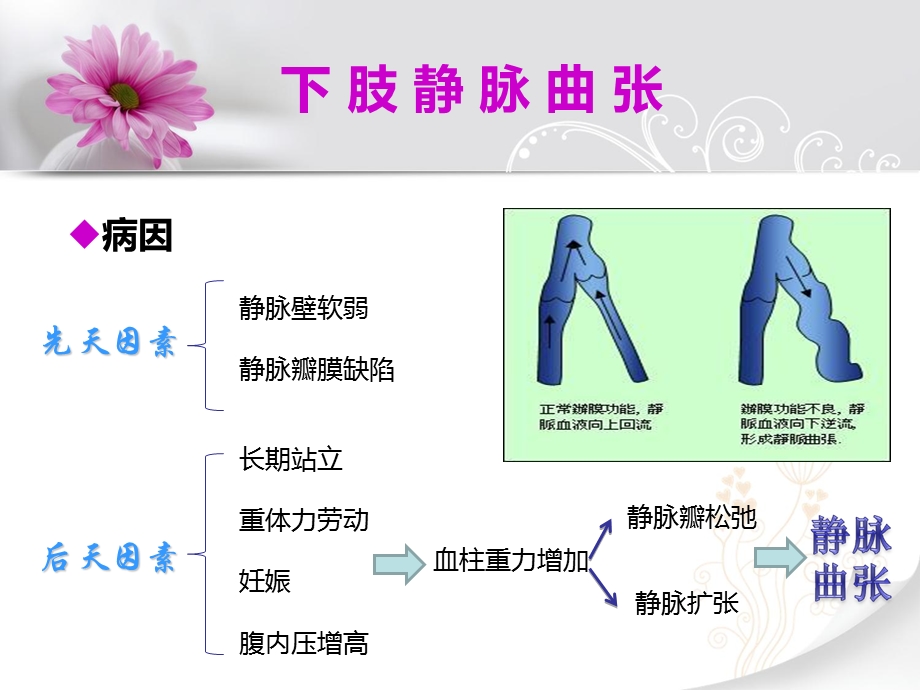 下肢静脉曲张的护理查房课件.ppt_第3页