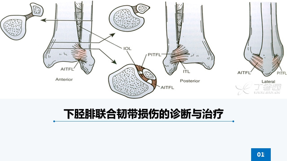 下胫腓联合韧带损伤ppt课件.ppt_第1页