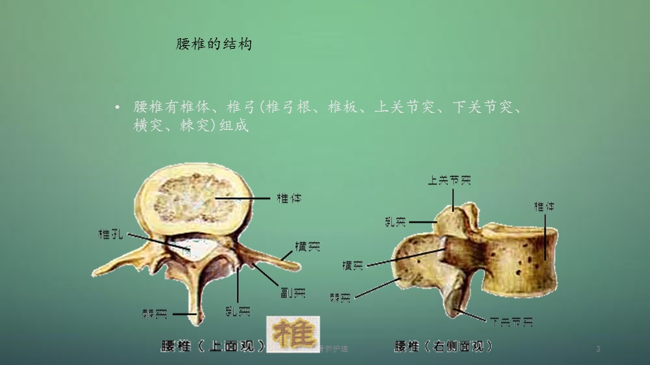 2020年腰椎骨折护理（课件）.ppt_第3页