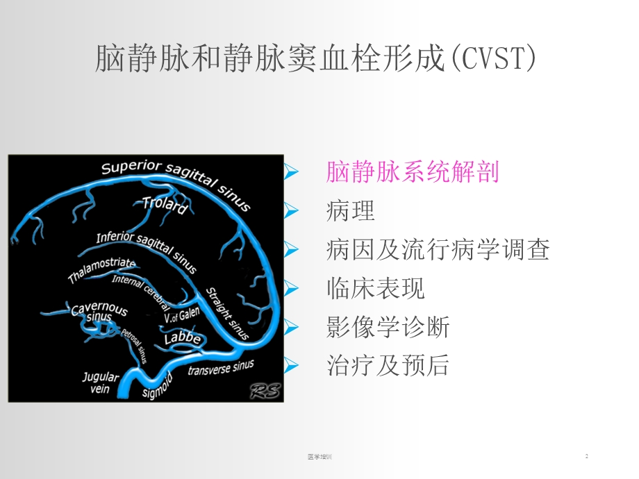 颅内静脉窦血栓形成终版(讲座类)课件.ppt_第2页