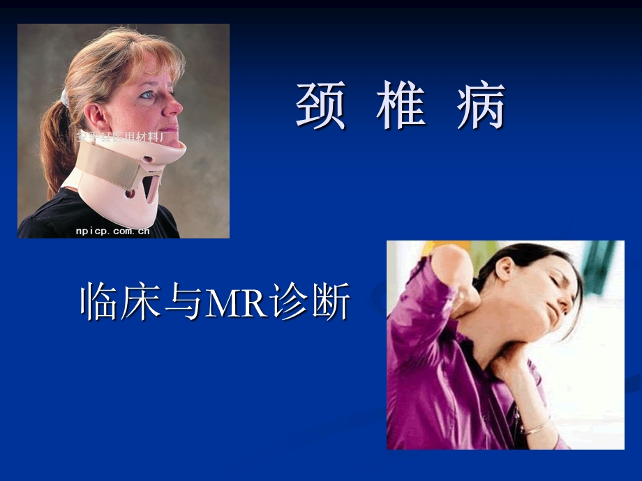 颈椎病的MRI诊断课件.ppt_第1页