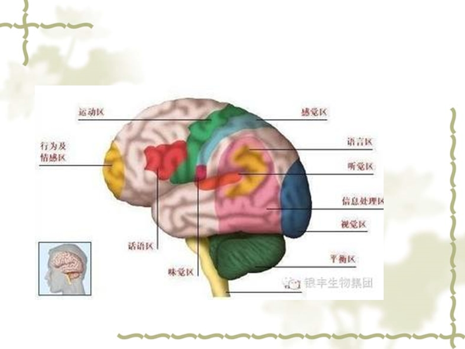 高血压脑出血的观察及护理要点演示ppt课件.ppt_第3页