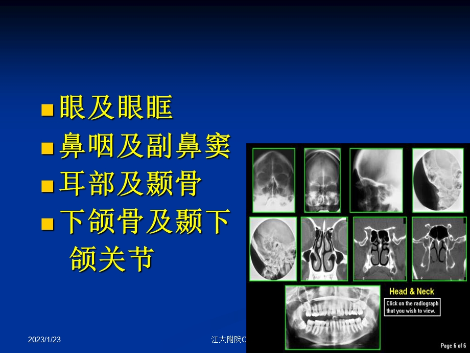 颜面部影像解剖学课件.ppt_第2页