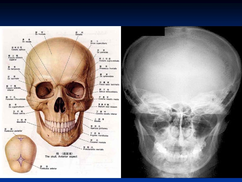 颜面部影像解剖学课件.ppt_第3页