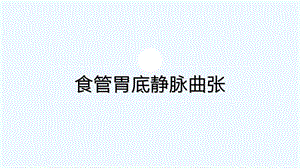 食管胃底静脉曲张护理查房课件.ppt