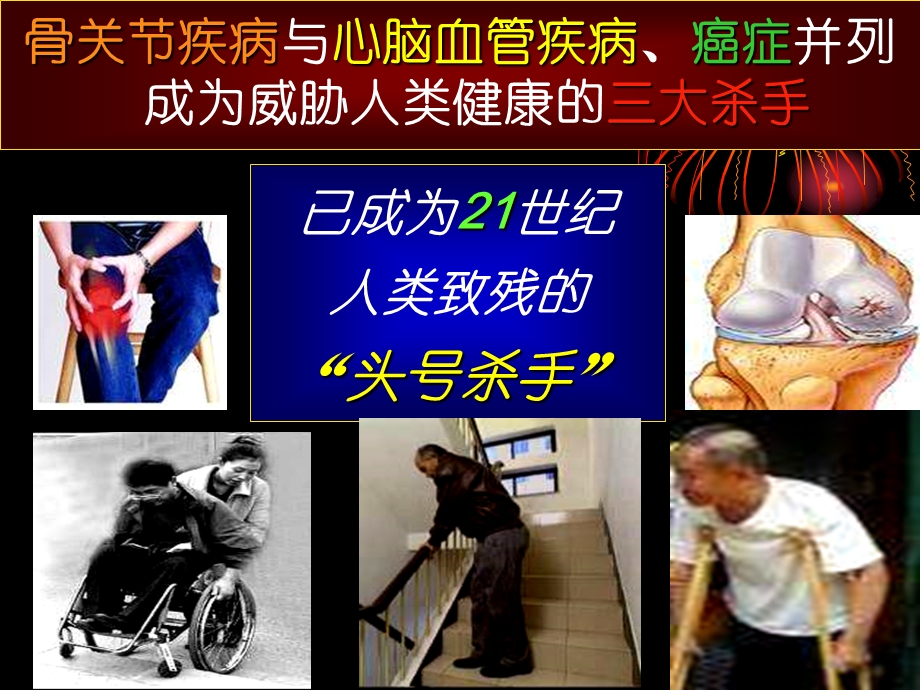 不死的癌症骨关节病ppt课件.ppt_第3页