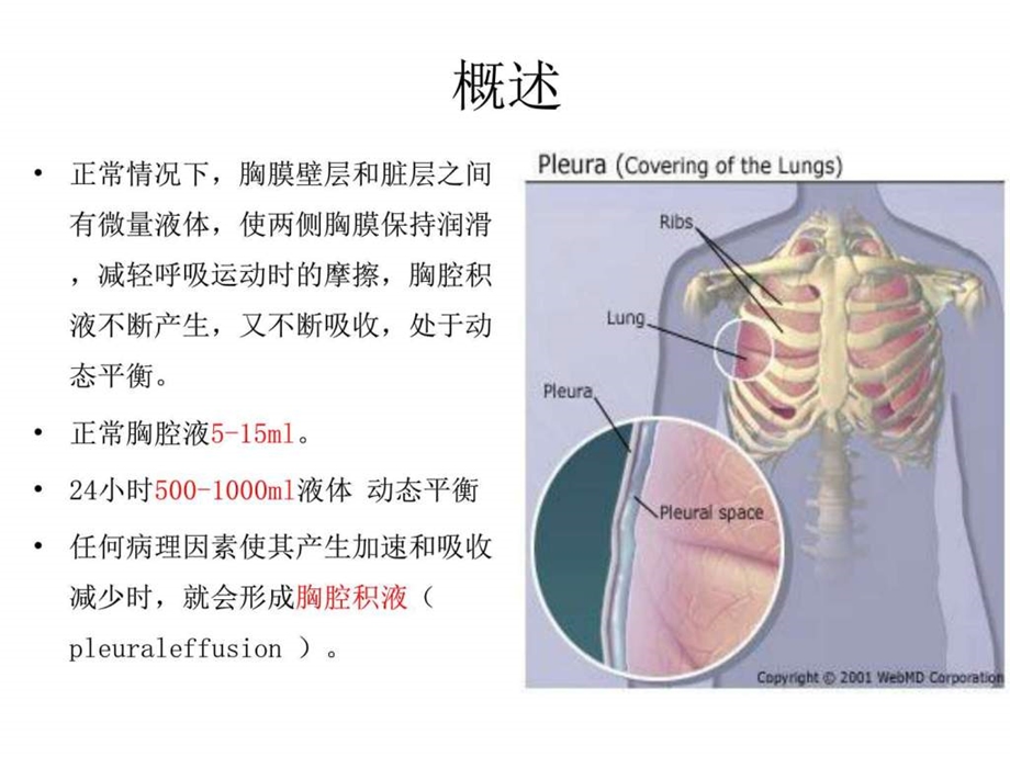 《胸腔积液鉴别诊断》课件.ppt_第2页