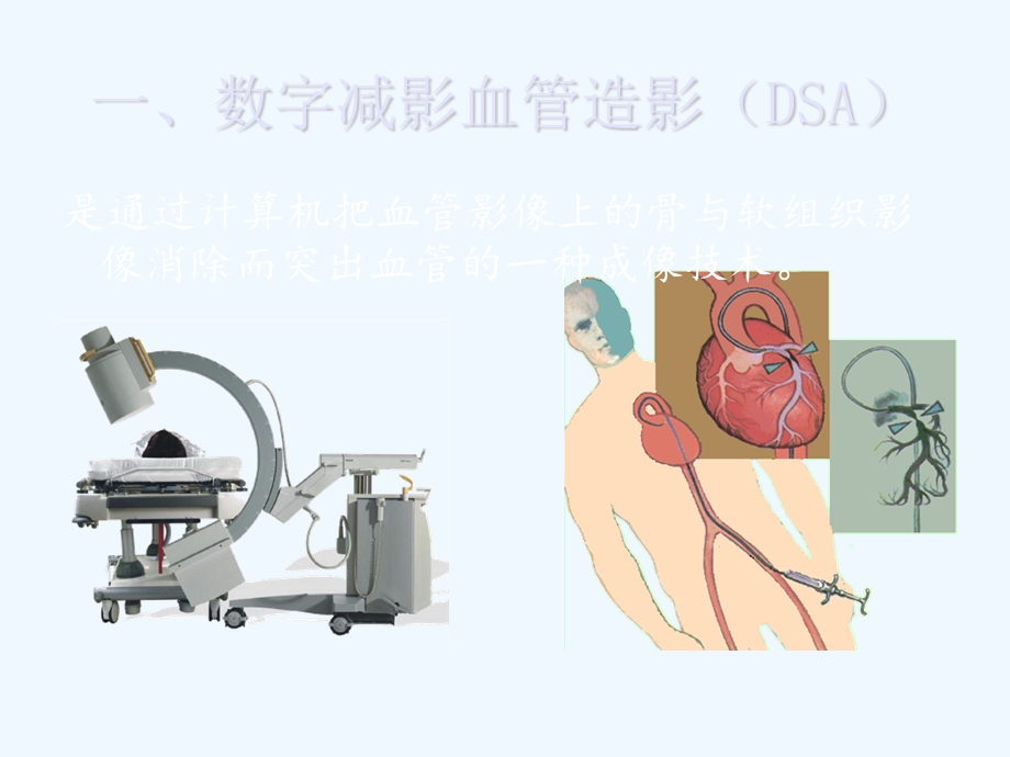 DSA成像技术讲解课件.ppt_第2页