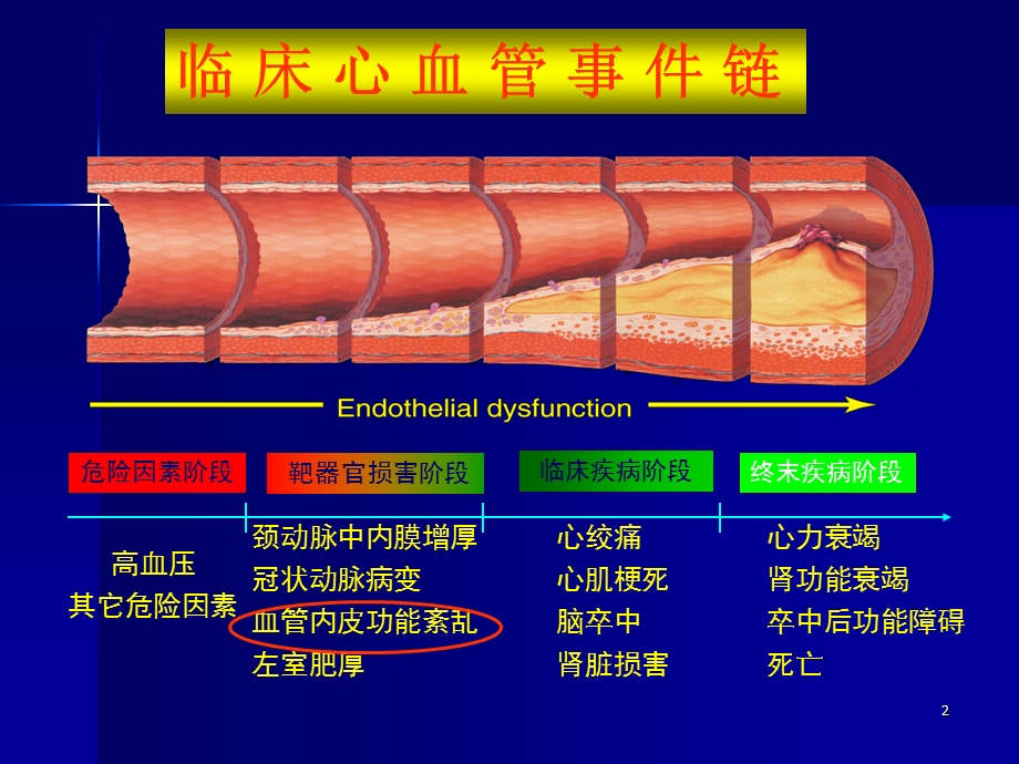 顽固性高血压课件.ppt_第2页