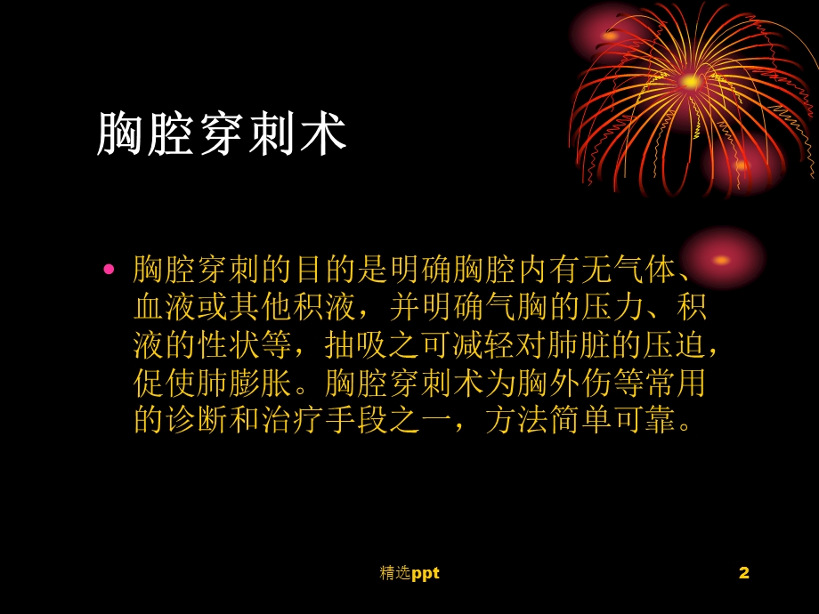 《胸腔穿刺术》课件.ppt_第2页