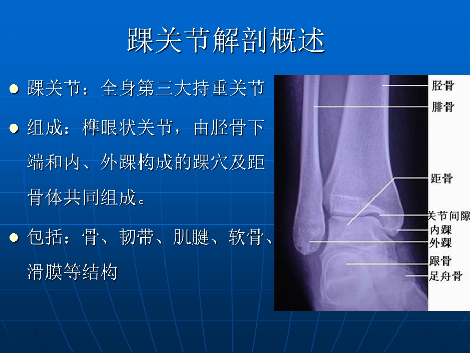 踝关节损伤磁共振诊断课件.ppt_第2页