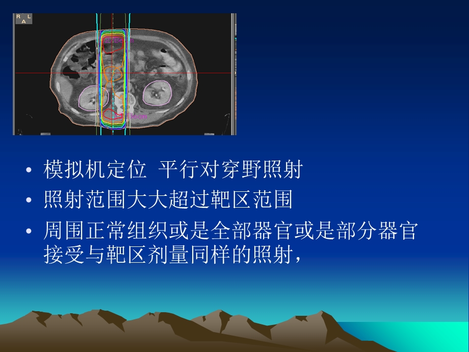 三维适形放疗中正常组织损伤及耐受剂量课件.ppt_第3页