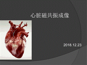 心脏磁共振成像)课件.ppt