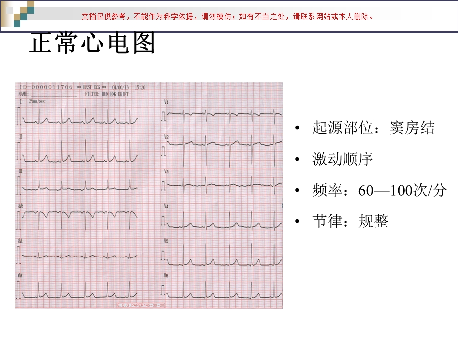 严重心律失常的急救和护理ppt课件.ppt_第3页