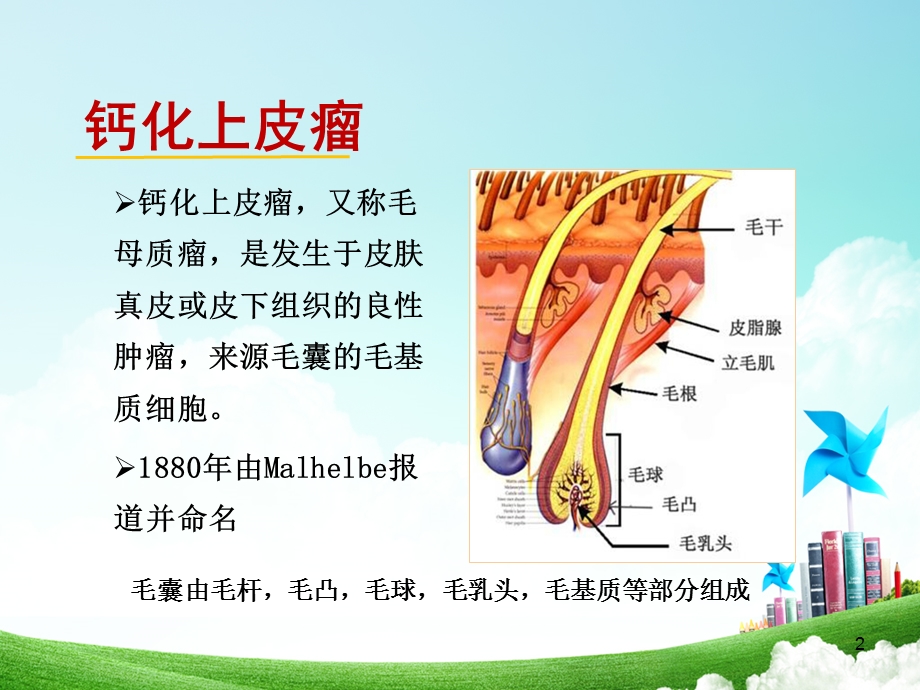 钙化上皮瘤的超声诊断课件.ppt_第2页