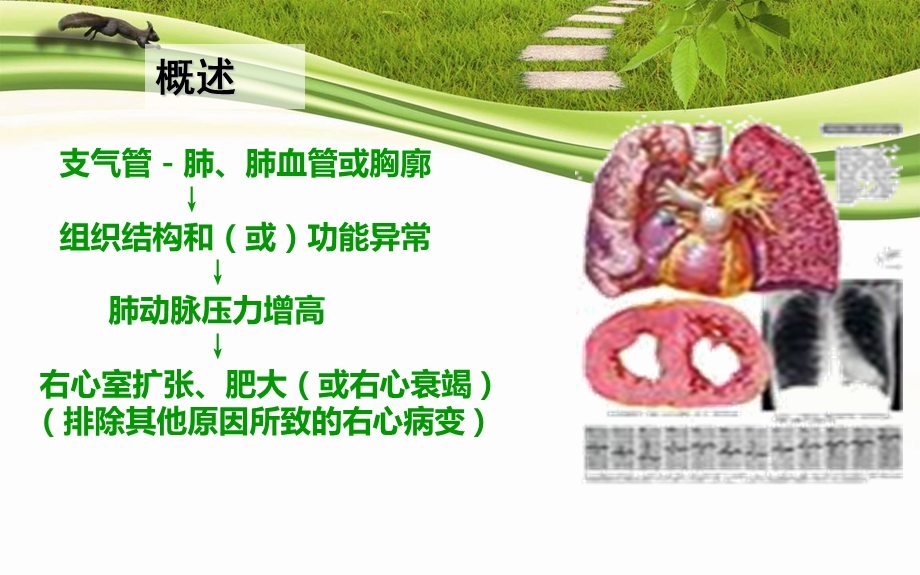 肺源性心脏病病人的护理课件.ppt_第2页