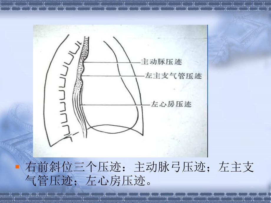 食管肿瘤影像诊断课件.pptx_第3页