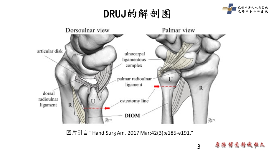 下尺桡关节不稳的病因与诊断课件.ppt_第3页