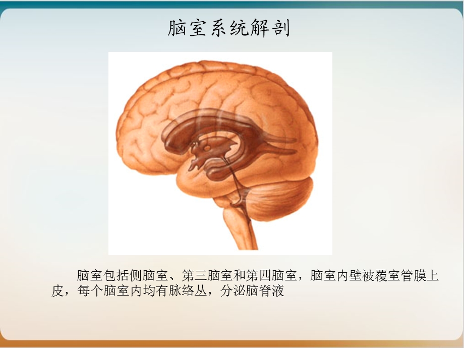 侧脑室肿瘤的诊断与鉴别 实用课件.ppt_第2页