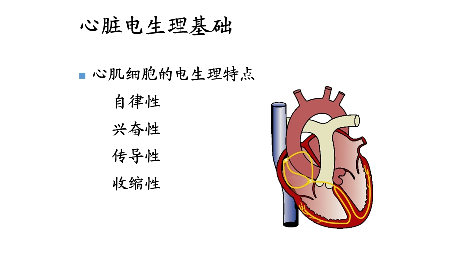 临时起搏器的护理查房修改课件.ppt_第3页