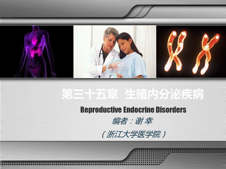 《妇产科学》生殖内分泌疾病课件.ppt_第2页