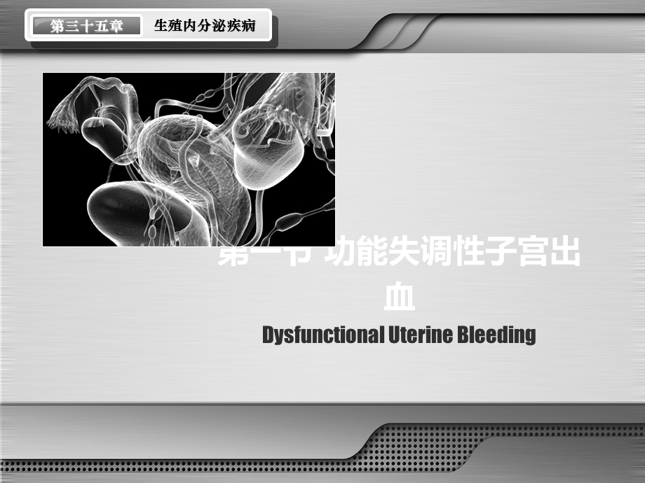 《妇产科学》生殖内分泌疾病课件.ppt_第3页