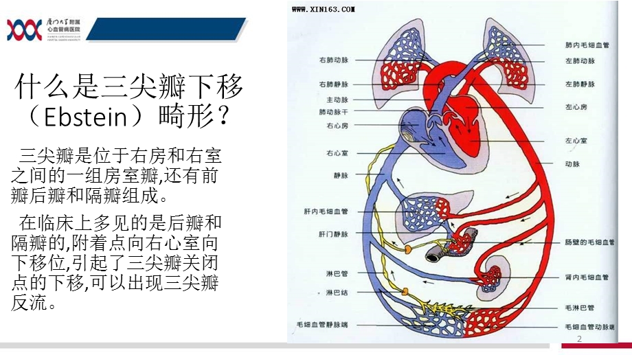 三尖瓣下移畸形的护理查房课件.ppt_第2页