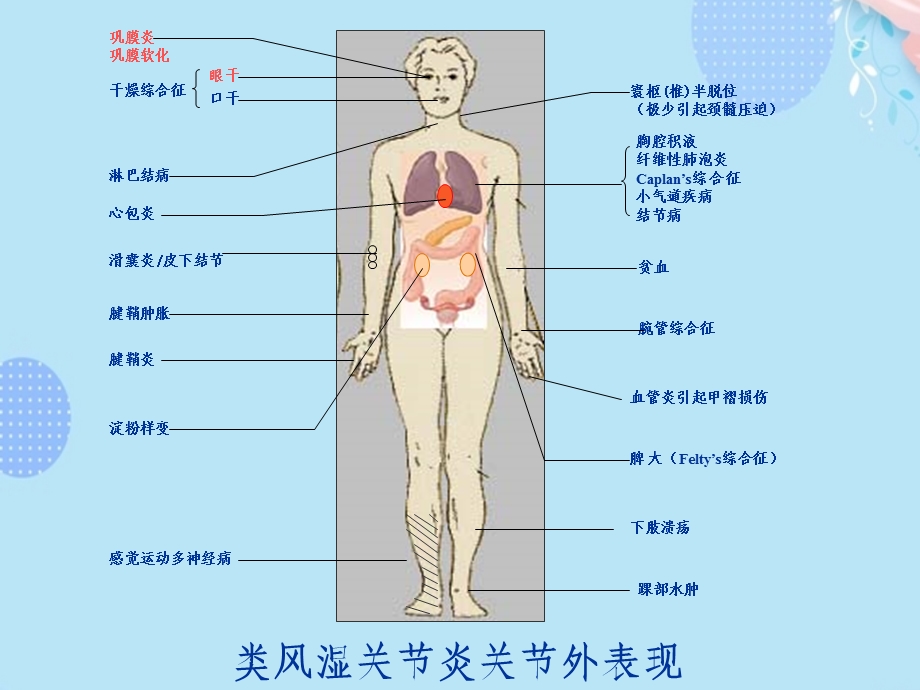 风湿科常用免疫抑制剂完整版课件.ppt_第2页