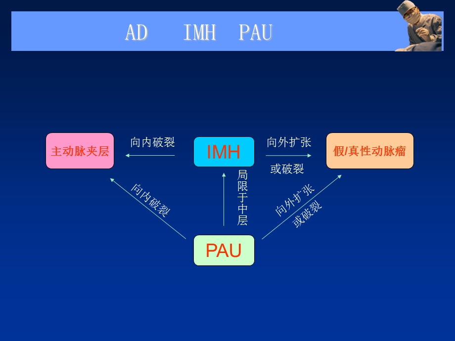 主动脉夹层、壁间血肿及穿通性溃疡影像诊断及鉴别诊断课件.ppt_第3页