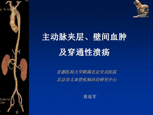 主动脉夹层、壁间血肿及穿通性溃疡影像诊断及鉴别诊断课件.ppt