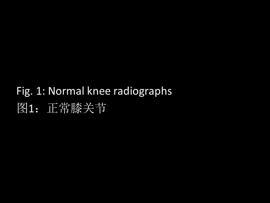 髌骨病变的影像学表现讲义课件.ppt_第1页