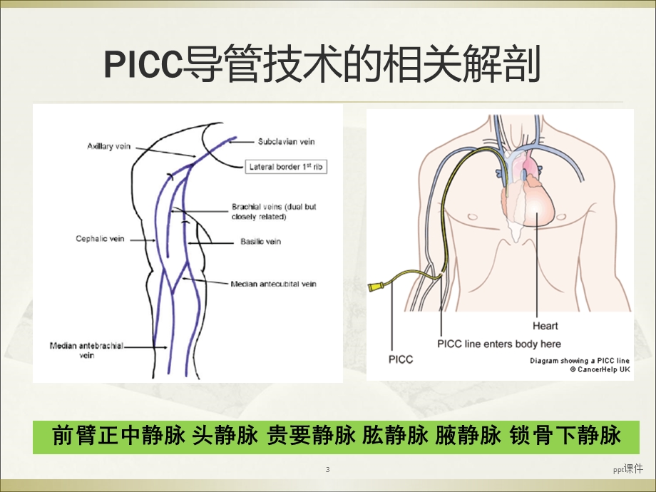 PICC导管头端定位与并发症处理课件.ppt_第3页