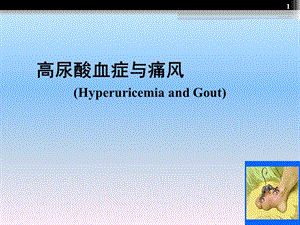 内科学：高尿酸血症与痛风课件.ppt