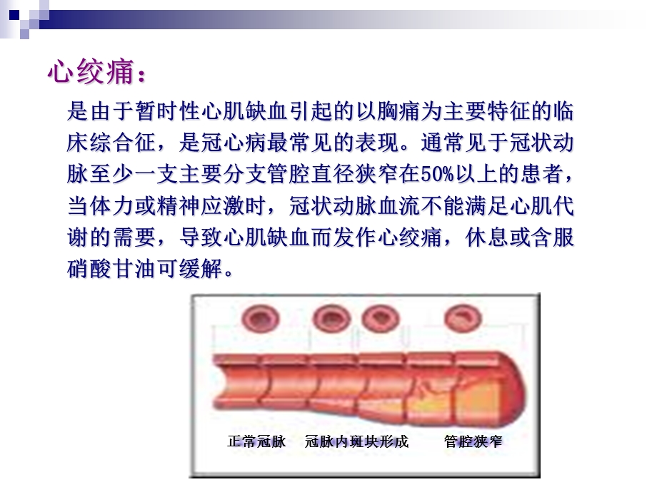 冠心病社区健康管理服务规范课件.ppt_第2页