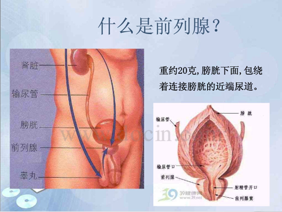 前列腺增生的护理查房最终版课件.ppt_第2页