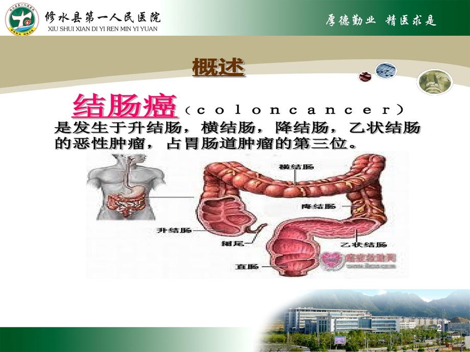 乙状结肠癌的护理查房课件.ppt_第2页