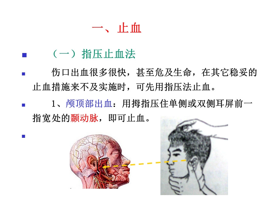 创伤现场急救四项基本技术课件.ppt_第3页