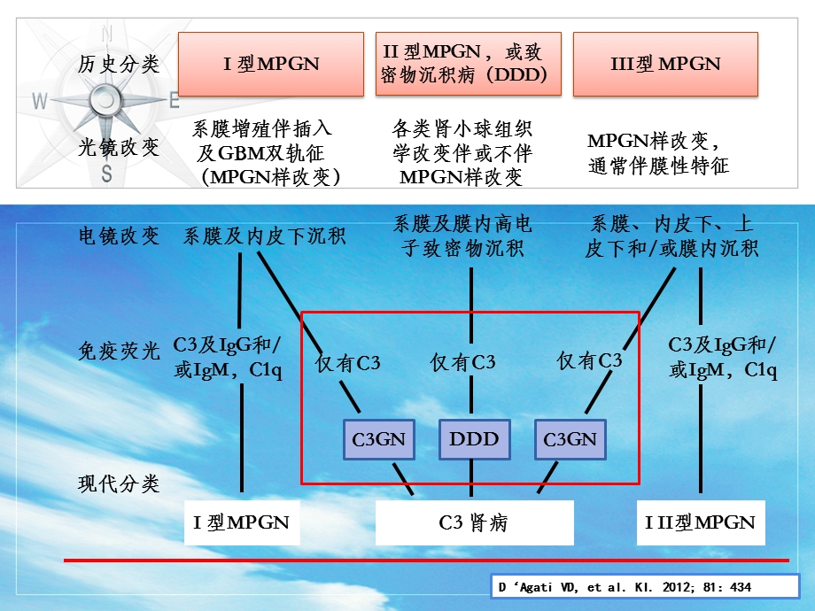 C3肾小球病新概念及专家共识课件.ppt_第3页