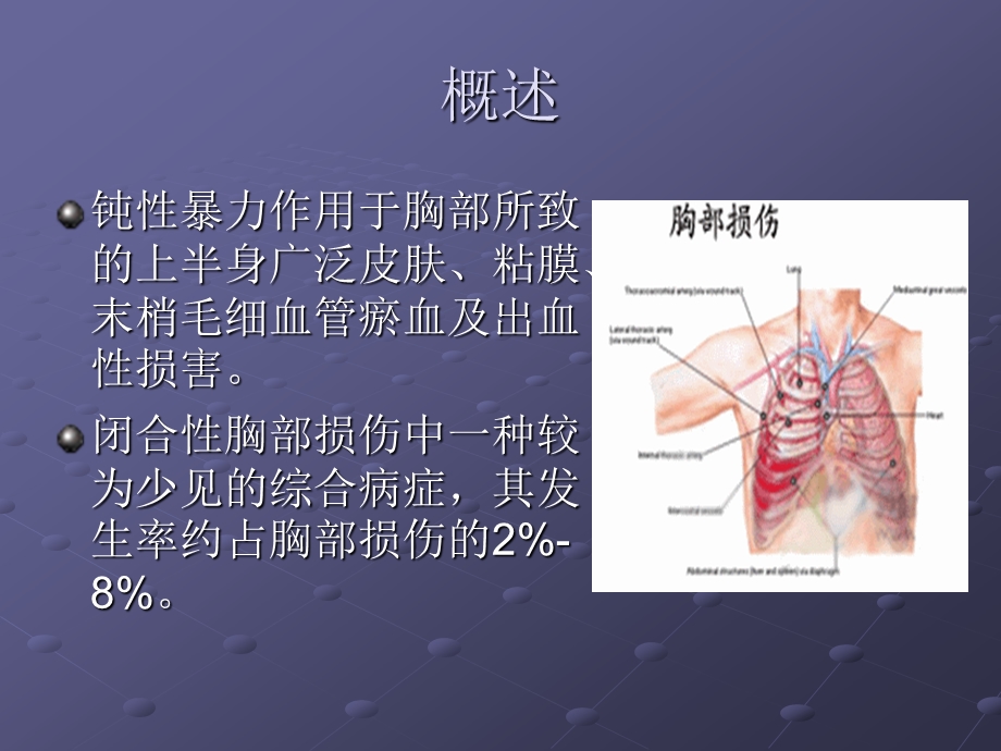 创伤性窒息ppt课件.ppt_第2页