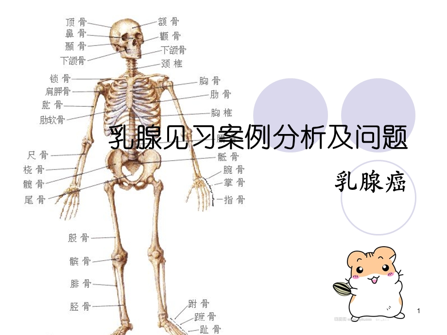 乳腺见习案例分析及问题课件.ppt_第1页