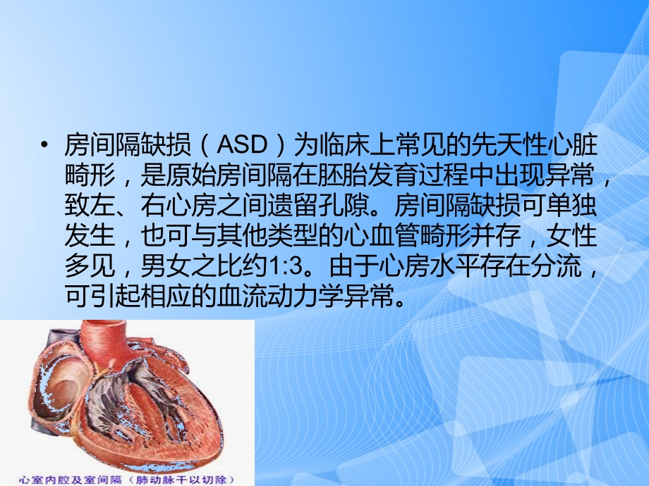 房间隔缺损护理查房PPT文档课件.ppt_第2页