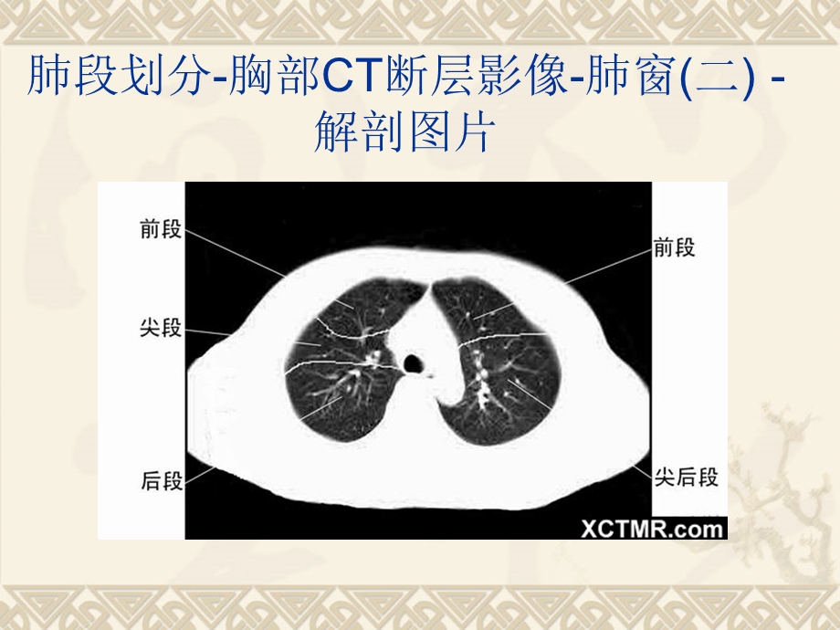 全身CT断层解剖详细实用图解教学文稿课件.ppt_第3页