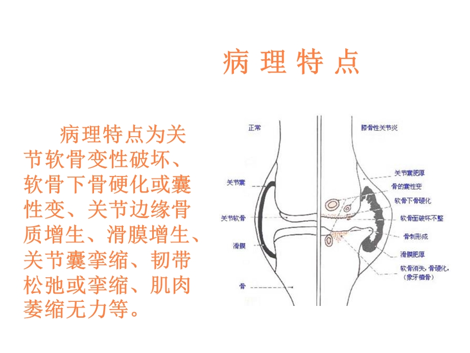 骨性关节炎的康复课件.ppt_第3页