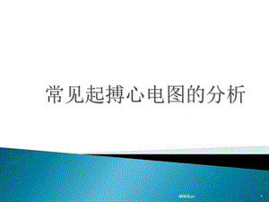 常见起搏心电图的分析课件.ppt