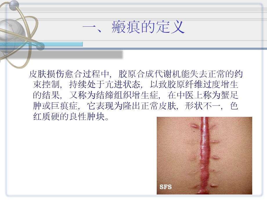 瘢痕与瘢痕疙瘩综合治疗课件.ppt_第3页