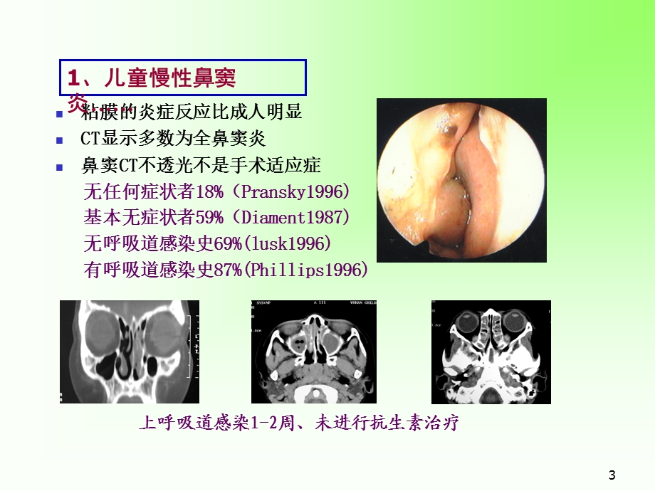 儿童慢性鼻窦炎课件.ppt_第3页