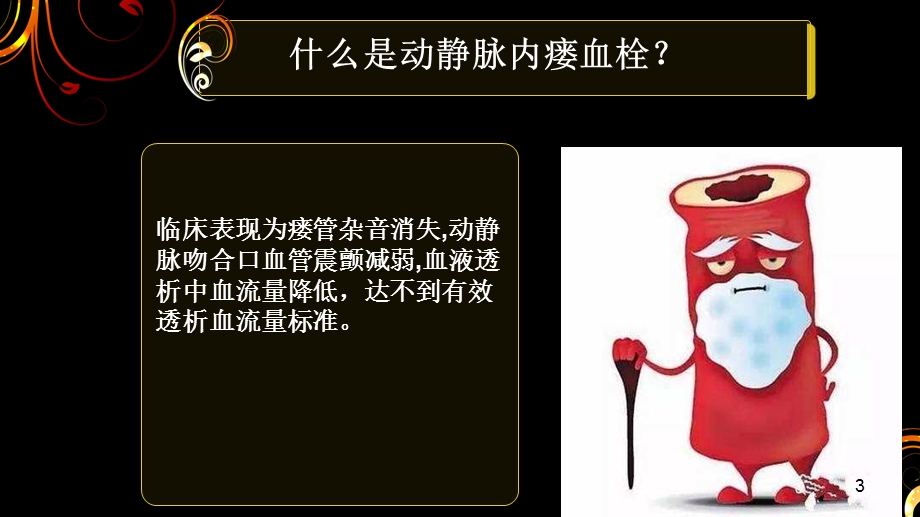 动静脉内瘘血栓的护理课件.ppt_第3页