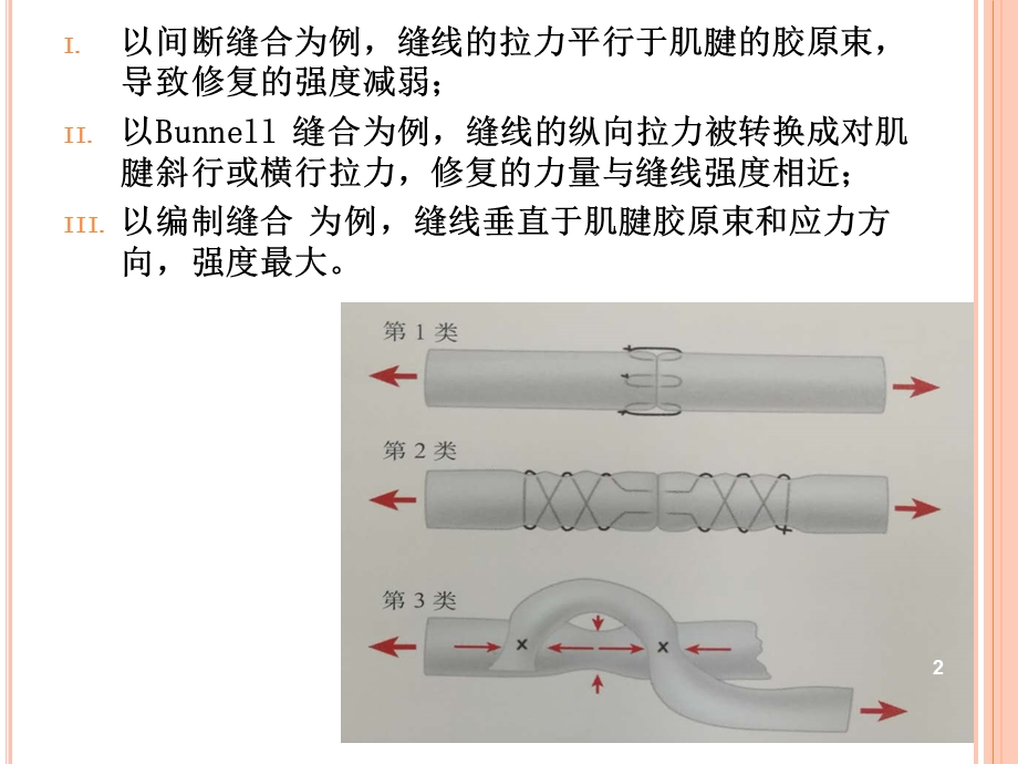 肌腱缝合技术课件.ppt_第2页